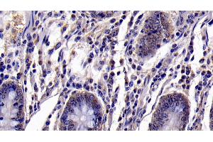Immunohistochemistry (IHC) image for anti-Caspase 6, Apoptosis-Related Cysteine Peptidase (CASP6) (AA 194-293) antibody (ABIN7437107)