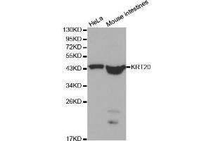 Western blot analysis of extracts of various cell lines, using KRT20 antibody. (KRT20 Antikörper  (AA 245-424))