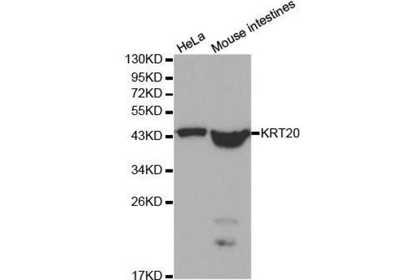 KRT20 Antikörper  (AA 245-424)