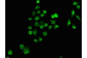 Immunofluorescence staining of PC-3 cells with ABIN7163013 at 1:100, counter-stained with DAPI. (PPARG Antikörper  (AA 1-477))
