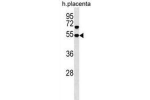 Western Blotting (WB) image for anti-Sorting Nexin Family Member 30 (SNX30) antibody (ABIN3000293) (SNX30 Antikörper)