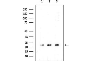 anti-Transgelin 2 (TAGLN2) (Internal Region) antibody