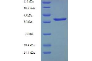 SDS-PAGE (SDS) image for Cysteine-Rich Protein 2 (CRIP2) (AA 1-208), (full length) protein (His-SUMO Tag) (ABIN4974388)