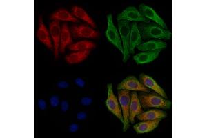 ABIN6262010 and ABIN6277327 staining Hela cells by IF/ICC.
