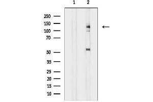 anti-Suppression of Tumorigenicity 5 (ST5) (Internal Region) antibody