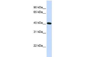 WB Suggested Anti-PITX2 Antibody Titration:  0. (PITX2 Antikörper  (N-Term))