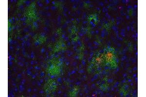 Indirect immunostaining of a PFA fixed formic acid treated brain section from a triple transgenic Alzheimer´s disease mouse with anti-Abeta 40 (dilution 1 : 500; red) and rabbit anti-Abeta (, dilution 1 : 500; green). (Abeta 1-40 Antikörper)