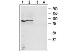 Western blot analysis of human PC3 Caucasian prostate adenocarcinoma (lanes 1 and 3) and human LNCaP prostate carcinoma (lanes 2 and 4) cell lysates: - 1,3. (TRPC4 Antikörper  (C-Term, Intracellular))