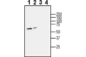 Western blot analysis of human  MG glioma cell line lysate (lanes 1 and 3) and human HUVEC endothelial cell line lysate (lanes 2 and 4):1-2.