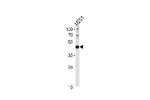 X6 Antibody (Center) (ABIN390916 and ABIN2841118) western blot analysis in  cell line lysates (35 μg/lane). (PAX6 Antikörper  (AA 183-210))