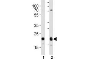 Western blot analysis of lysate from (1) HeLa and (2) MCF-7 cell line using CD9 antibody at 1:1000. (CD9 Antikörper  (AA 115-145))