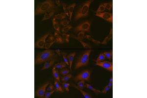 Immunofluorescence analysis of U-2 OS cells using BMP6 Rabbit mAb (ABIN7265900) at dilution of 1:100 (40x lens). (BMP6 Antikörper)