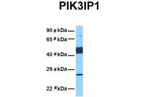 Host:  Rabbit  Target Name:  PIK3IP1  Sample Tissue:  Human Lung Tumor  Antibody Dilution:  1. (PIK3IP1 Antikörper  (Middle Region))