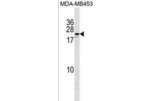 ZN Antibody (Center) (ABIN1538689 and ABIN2850066) western blot analysis in MDA-M cell line lysates (35 μg/lane). (ZNF580 Antikörper  (AA 91-119))