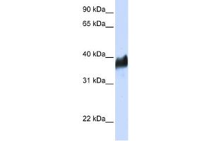 WB Suggested Anti-CLN8 Antibody Titration:  0. (CLN8 Antikörper  (N-Term))