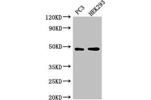 Western Blot Positive WB detected in: PC-3 whole cell lysate, HEK293 whole cell lysate All lanes: ACTR10 antibody at 3 μg/mL Secondary Goat polyclonal to rabbit IgG at 1/50000 dilution Predicted band size: 47 kDa Observed band size: 47 kDa (ACTR1 Antikörper  (AA 165-417))