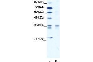 WB Suggested Anti-BARX1 Antibody   Titration: 1. (BARX1 Antikörper  (Middle Region))