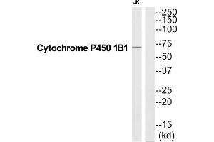 Western Blotting (WB) image for anti-Cytochrome P450, Family 1, Subfamily B, Polypeptide 1 (CYP1B1) (C-Term) antibody (ABIN1852631) (CYP1B1 Antikörper  (C-Term))