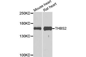 Western blot analysis of extracts of various cell lines, using THBS2 antibody. (Thrombospondin 2 Antikörper)