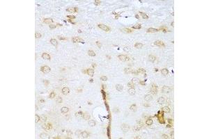 Immunohistochemistry (Paraffin-embedded Sections) (IHC (p)) image for anti-Ubiquitin-Conjugating Enzyme E2L 3 (UBE2L3) (AA 73-212) antibody (ABIN1683196)