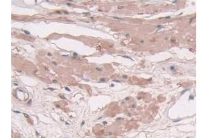 Detection of TAGLN in Human Prostate Tissue using Polyclonal Antibody to Transgelin (TAGLN) (Transgelin Antikörper  (AA 1-201))