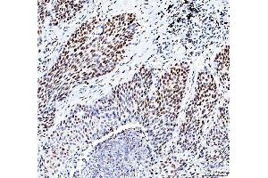 IHC analysis of HDAC2 using anti-HDAC2 antibody (ABIN7601564). (HDAC2 Antikörper  (AA 387-488))