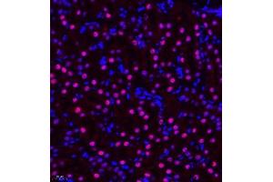 Immunofluorescence of paraffin embedded mouse kidney using ZHX3 (ABIN7076287) at dilution of 1:650 (400x lens) (ZHX3 Antikörper)