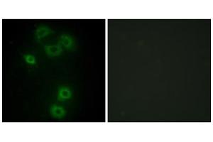 Immunofluorescence analysis of A549 cells, using BMX antibody.