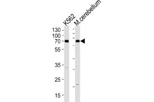 Western Blotting (WB) image for anti-EPM2A (Laforin) Interacting Protein 1 (EPM2AIP1) antibody (ABIN3004753) (EPM2AIP1 Antikörper)