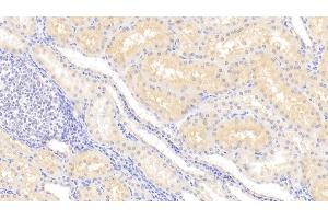 Detection of LCN12 in Human Kidney Tissue using Polyclonal Antibody to Lipocalin 12 (LCN12) (LCN12 Antikörper  (AA 61-184))