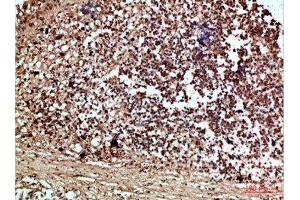 Immunohistochemical analysis of paraffin-embedded human-thyroid, antibody was diluted at 1:200 (RCC1 Antikörper  (AA 301-350))