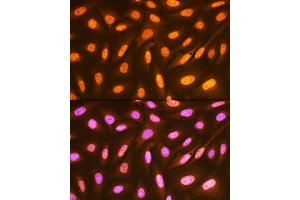 Immunofluorescence analysis of U-2 OS cells using FUBP1 Rabbit mAb (ABIN7267128) at dilution of 1:100 (40x lens). (FUBP1 Antikörper)
