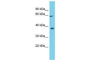 Host: Rabbit  Target Name: Cyp1b1  Sample Tissue: Rat Testis lysates  Antibody Dilution: 1. (CYP1B1 Antikörper  (C-Term))