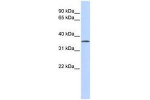 Image no. 1 for anti-Tissue Specific Transplantation Antigen P35B (TSTA3) (N-Term) antibody (ABIN6741483)
