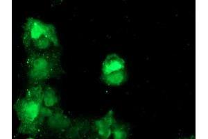 Anti-TBCC mouse monoclonal antibody (ABIN2455797) immunofluorescent staining of COS7 cells transiently transfected by pCMV6-ENTRY TBCC (RC203563). (TBCC Antikörper)
