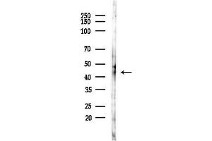 Western blot analysis of lysates from COLO205 cells(heat-shock,45 min treatment), using LHX3 Antibody at 1/1000 dilution.