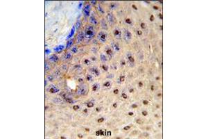 Formalin-fixed and paraffin-embedded human skin reacted with PAX3 Antibody (N-term), which was peroxidase-conjugated to the secondary antibody, followed by DAB staining. (Paired Box 3 Antikörper  (N-Term))