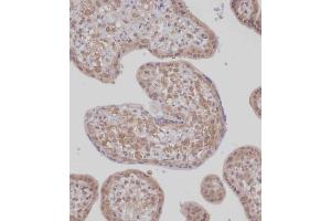 Immunohistochemical analysis of (ABIN1539451 and ABIN2848995) on paraffin-embedded Human placenta tissue. (TET2 Antikörper  (N-Term))