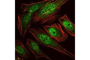 Immunofluorescence analysis of Hela cells using RUNX1 mouse mAb (green).