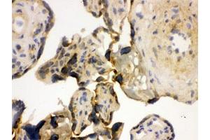 IHC testing of frozen human placenta with YB1 antibody. (YBX1 Antikörper)