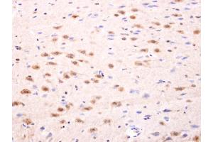 IHC-P Image Islet 1 antibody detects Islet 1 protein at nucleus on rat fore brain by immunohistochemical analysis. (ISL1 Antikörper)