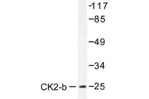 Image no. 1 for anti-Casein Kinase 2, beta (CSNK2B) antibody (ABIN272014) (CSNK2B Antikörper)