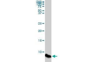 ATOX1 monoclonal antibody (M08), clone 4D6. (ATOX1 Antikörper  (AA 1-68))