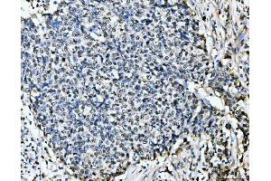 IHC analysis of MCM6 using anti-MCM6 antibody (ABIN7600038). (MCM6 Antikörper  (AA 14-821))