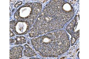 IHC analysis of Aconitase 2 using anti-Aconitase 2 antibody (ABIN7602770). (ACO2 Antikörper  (C-Term))