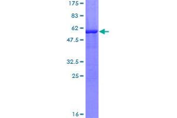 TTPA Protein (AA 1-278) (GST tag)