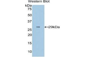Western Blotting (WB) image for anti-CD36 (CD36) (AA 91-311) antibody (ABIN1859048)