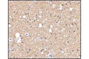 Immunohistochemical staining of human brain tissue using AP30785PU-N SIRT2 antibody at 2. (SIRT2 Antikörper  (C-Term))