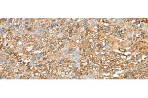 Immunohistochemistry of paraffin-embedded Human tonsil tissue using LGALS9 Polyclonal Antibody at dilution of 1:40(x200) (Galectin 9 Antikörper)