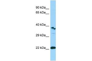 Western Blotting (WB) image for anti-Triggering Receptor Expressed On Myeloid Cells-Like 1 (TREML1) (Middle Region) antibody (ABIN2790139) (TREML1 Antikörper  (Middle Region))